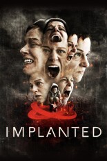 Implanted