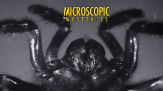 Microscopic Mysteries