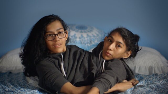 Extraordinary People: Conjoined Twins: Inseparable
