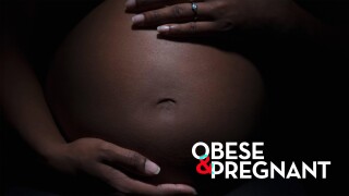 Obese and Pregnant