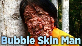 Bubble Skin Man