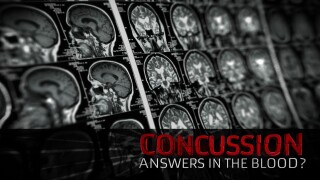 Concussion: Answers in the Blood?