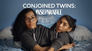 Extraordinary People: Conjoined Twins: Inseparable