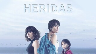 Heridas