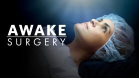 Awake Surgery